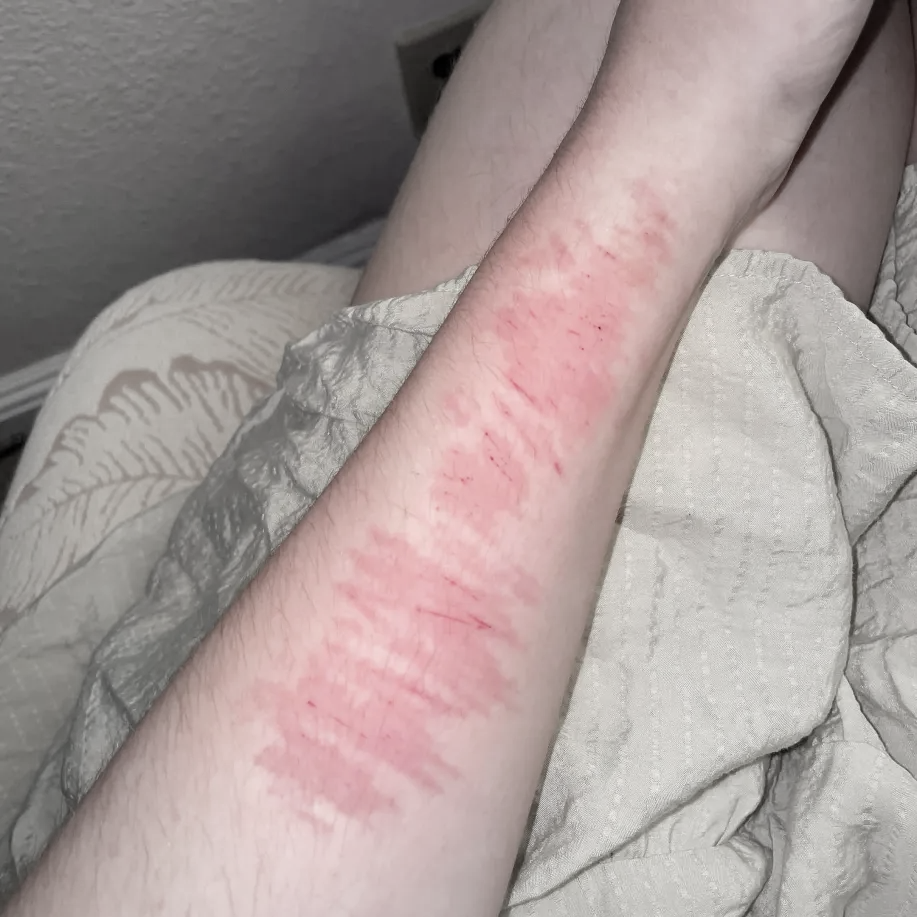 tiny little cute cat scratches