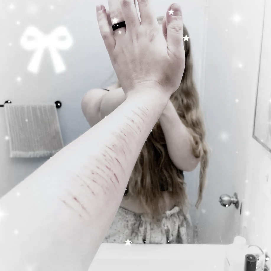 healing marks